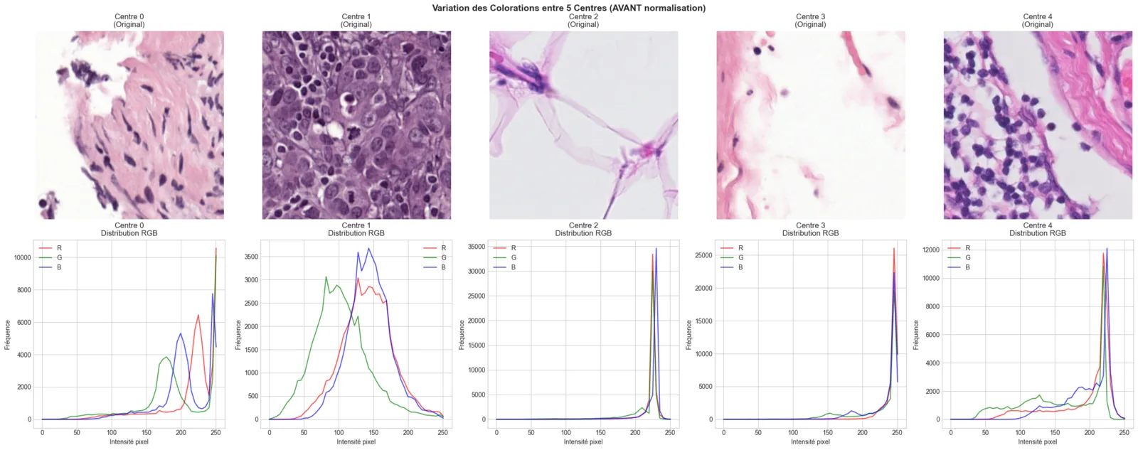 One H&E patch per hospital center (0 to 4) above its RGB histogram, showing very different stains before normalization