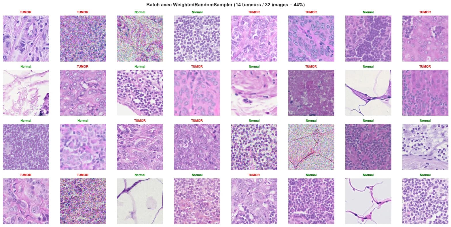 A batch of 32 patches rebalanced by WeightedRandomSampler, each patch labeled Normal or Tumor