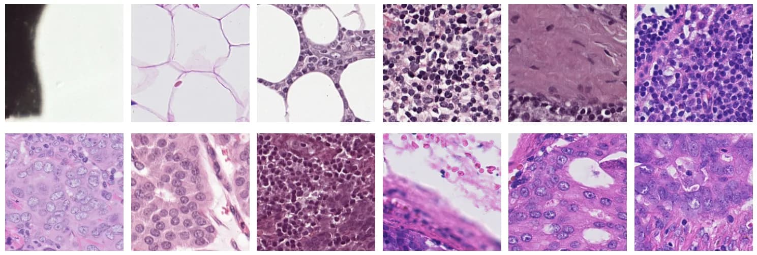 Twelve 224-pixel H&E histopathology patches: normal tissue on the top row, metastases on the bottom row